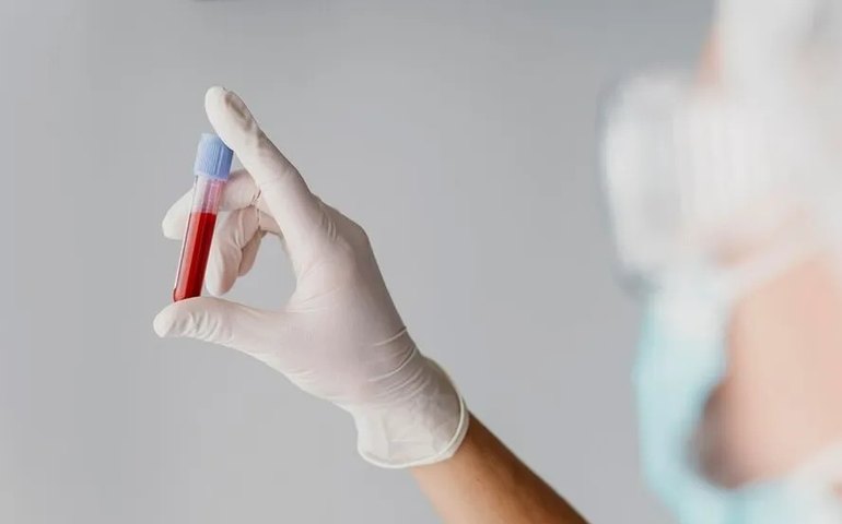 Autoridades de saúde investigam doença misteriosa no Congo após 143 mortes