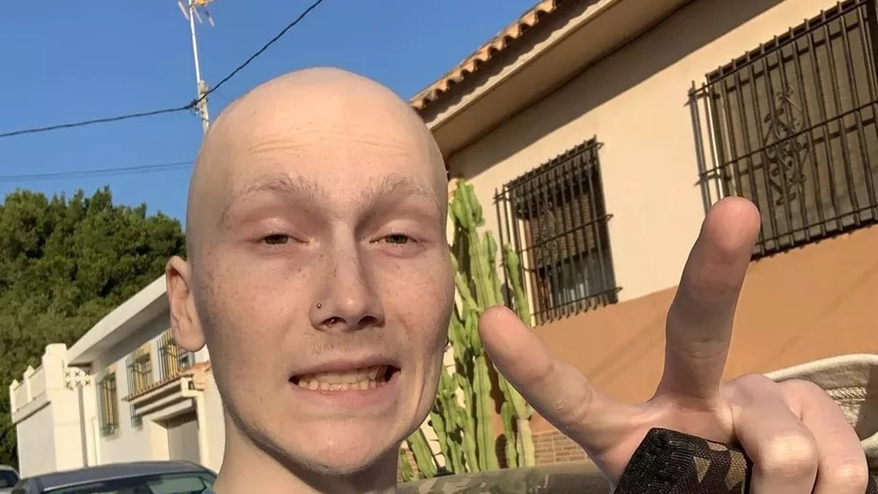 Tiktoker que mostrava luta contra o câncer morre aos 20 anos