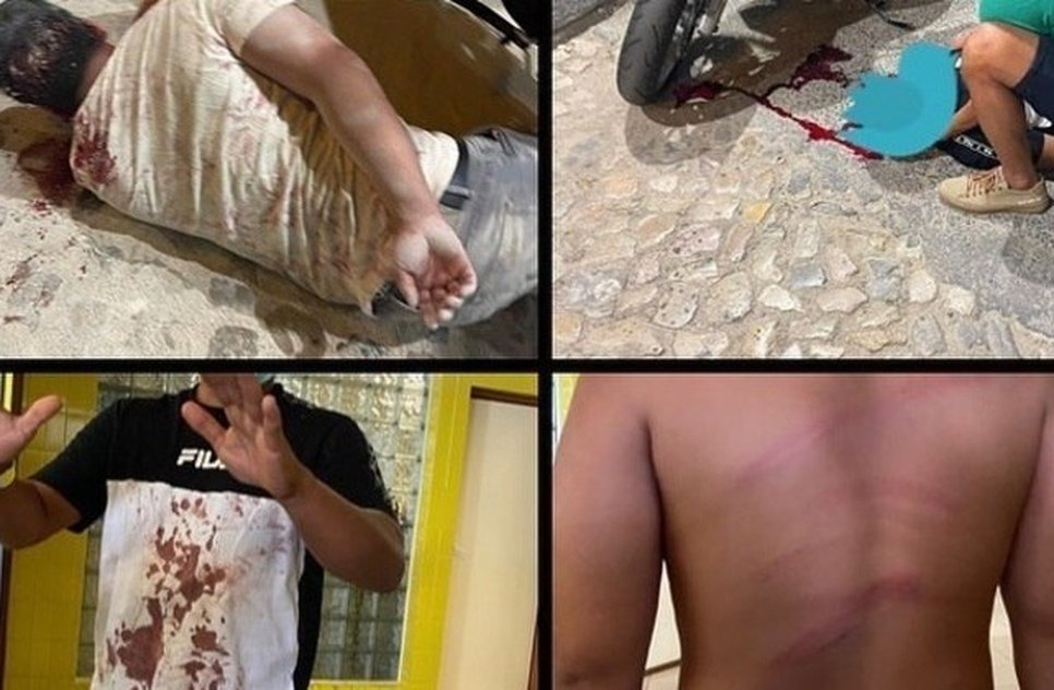 agressao-boate-portugal-10082022190737343 / Foto: REPRODUÇÃO FACEBOOK/GISLAINE ROSA