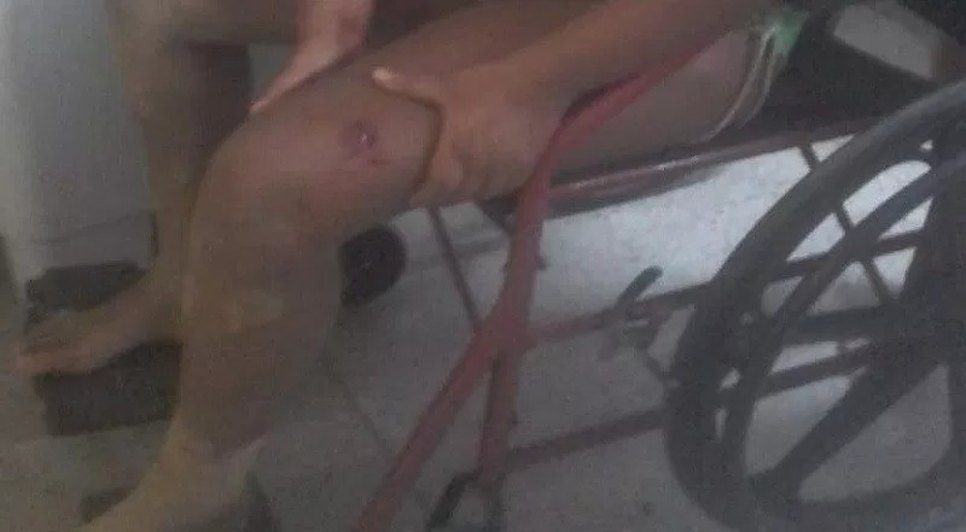 tiro de raspão