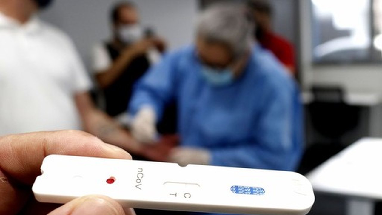 Testagem eficaz permite reabrir, diz pesquisa