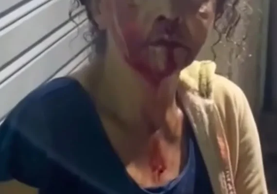 Acusado de espancar esposa em via pública é solto em audiência de custódia