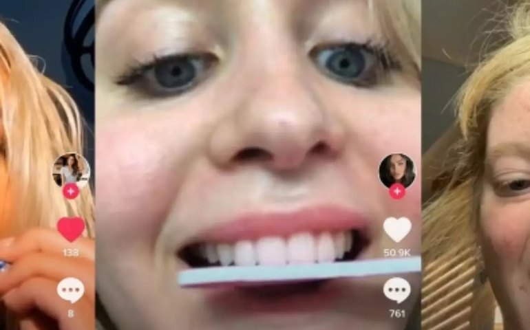 Abrir pacotes com os dentes pode causar rachaduras? Vídeo de dentista no TikTok viraliza com 3 ações que devem ser evitadas; confira
