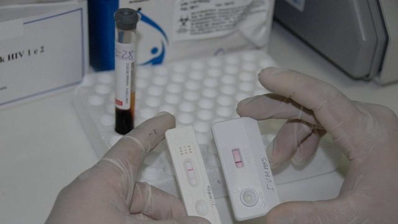 Saúde quer reverter quadro de infecção de DST/Aids em Unidades de Internação
