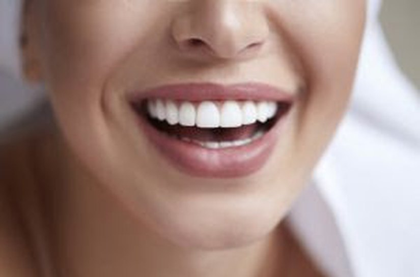 Dia Mundial do Sorriso: o guia definitivo para dentes saudáveis e bonitos