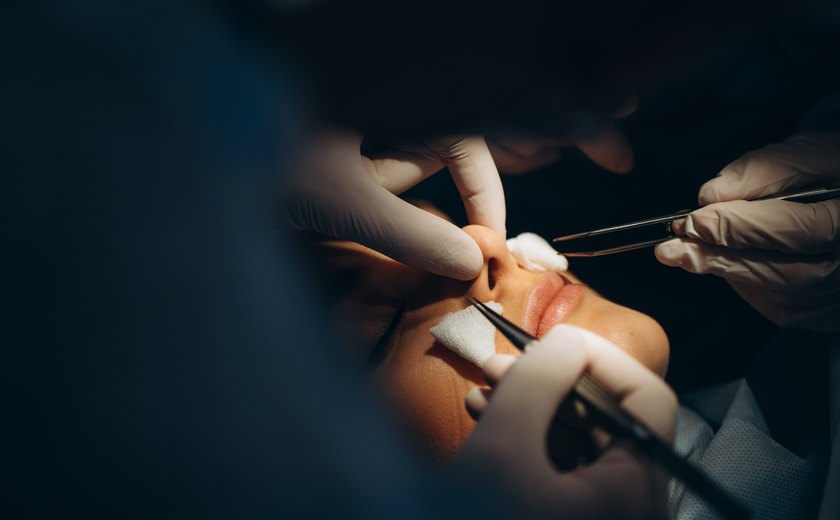 Rinoplastia Ultrassônica é inovação precisa na arte da cirurgia nasal