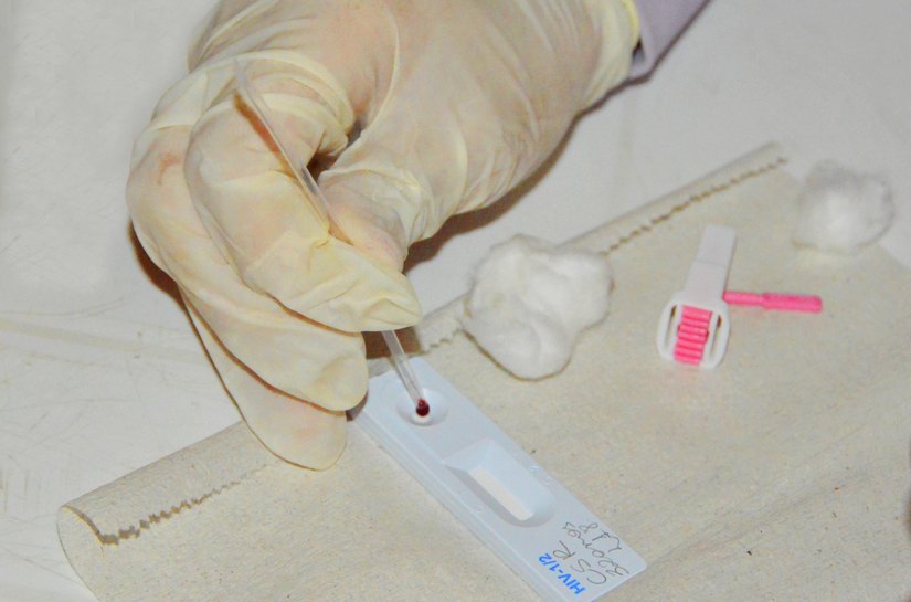 Secretaria de Estado da Saúde orienta sobre prevenção e tratamento da sífilis