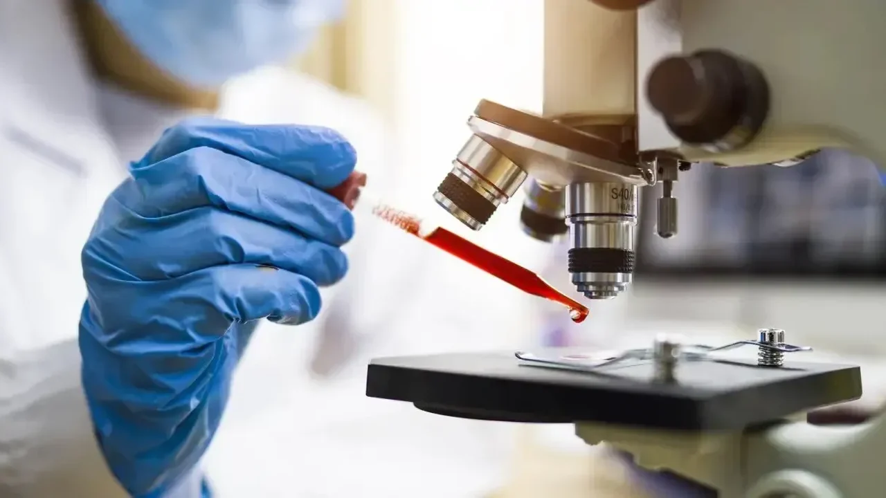 Novo exame de sangue com IA prevê risco de 6 doenças cardiovasculares até 15 anos antes dos sintomas