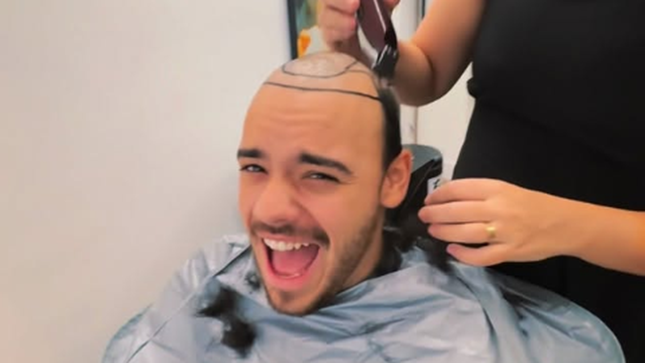 Influenciador Gabriel Rocha faz implante capilar e celebra nova fase: 'Em busca da minha autoconfiança'