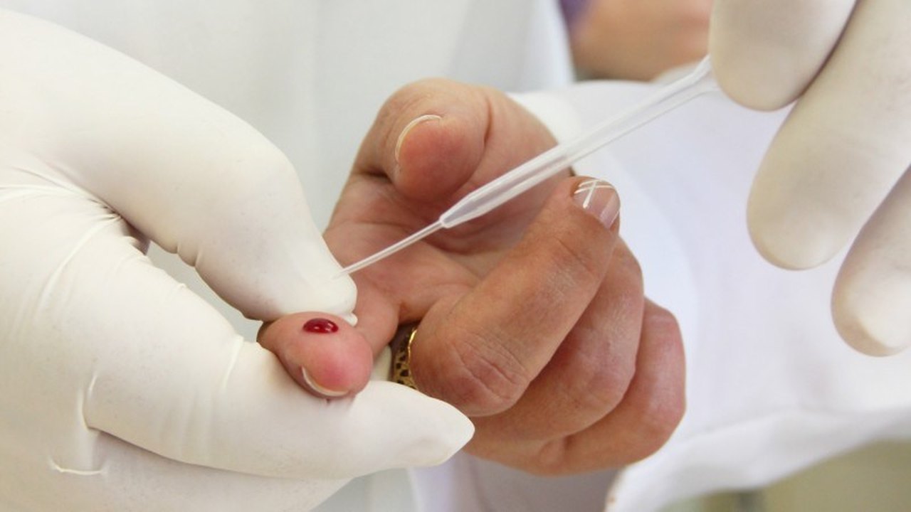 Espírito Santo vai fazer teste de anticorpos da covid-19 em 30 mil pessoas