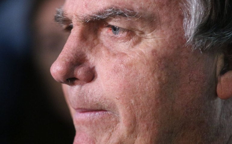 Bolsonaro passa por nova cirurgia após crise persistente de soluços