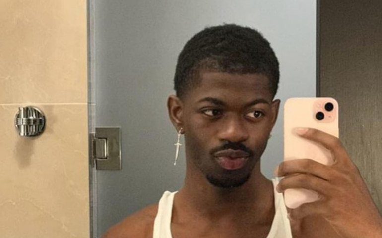 Lil Nas X é internado com paralisia facial: 'Vou ficar engraçado por um tempo'