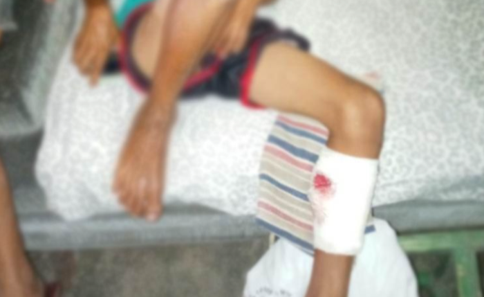 Criança foi atingida na perna por disparos efetuados pelo militar