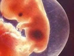China tem 13 milhões de aborto por ano