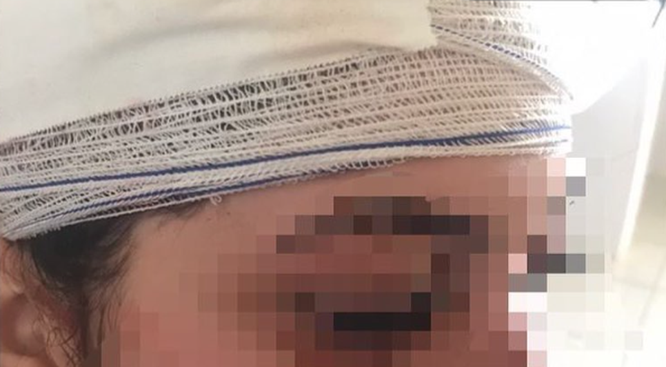 Mulher é empurrada e agredida durante festa em Itabaiana
