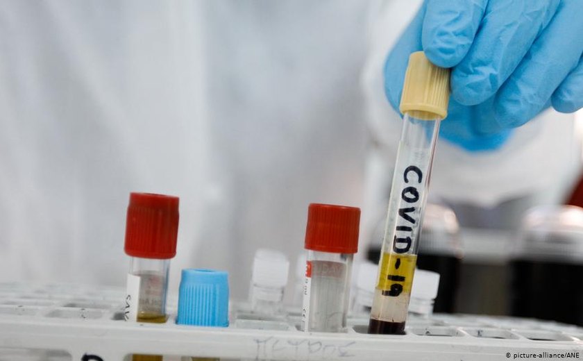 Brasil pode virar grande laboratório de testes para vacina contra covid-19