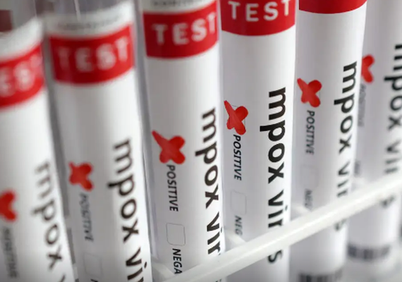 Brasil contabiliza 1,5 mil casos de mpox em 2024