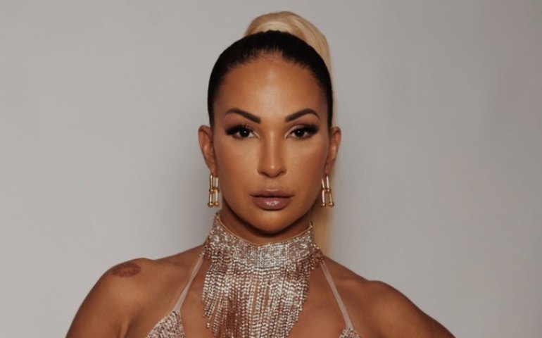 Valesca Popozuda revela procedimento estético que não deu certo: 'Sofri muito em busca de uma perfeição'