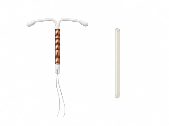 DIU e Implanon®: o que muda entre os contraceptivos de longa duração?