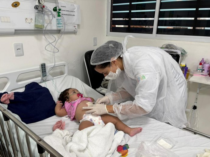 Enfermeiras do Hospital da Criança de Alagoas alertam sobre o que fazer em caso de queimaduras nas festas juninas