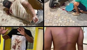 agressao-boate-portugal-10082022190737343 / Foto: REPRODUÇÃO FACEBOOK/GISLAINE ROSA