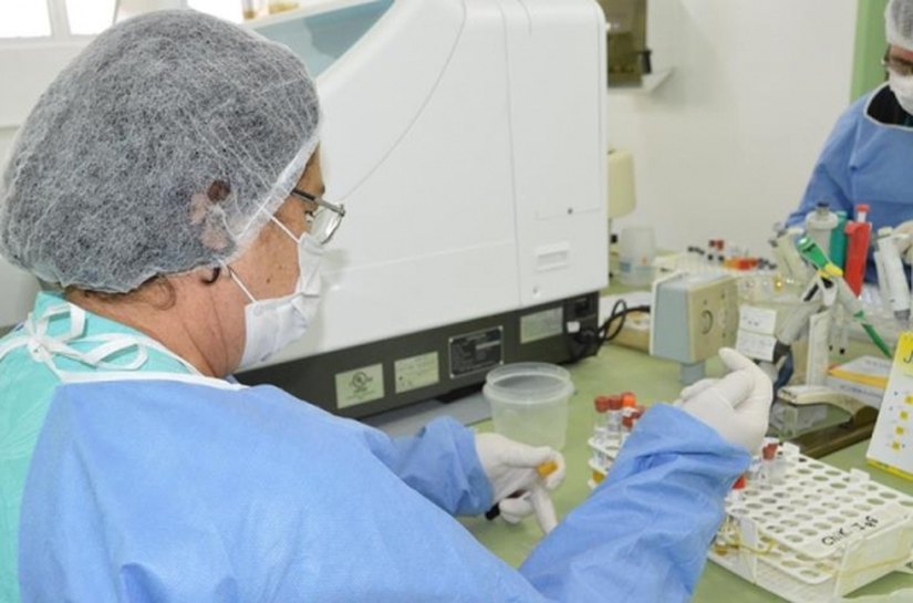 Sesau firma parceria técnica com a Organização Pan Americana de Saúde