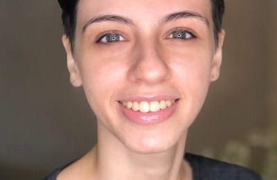 Dia Roxo: Campanha busca informar população sobre a Epilepsia