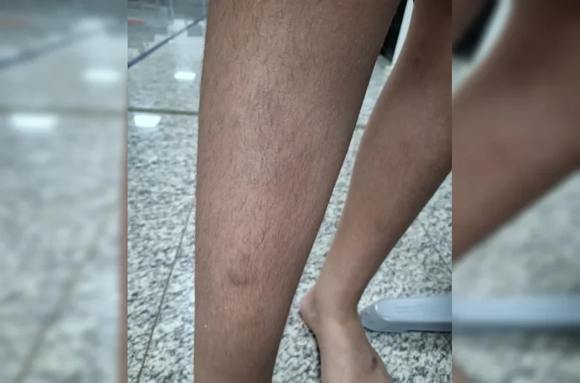 Aluno de 10 anos é cercado e agredido por grupo de colegas em colégio militar do DF