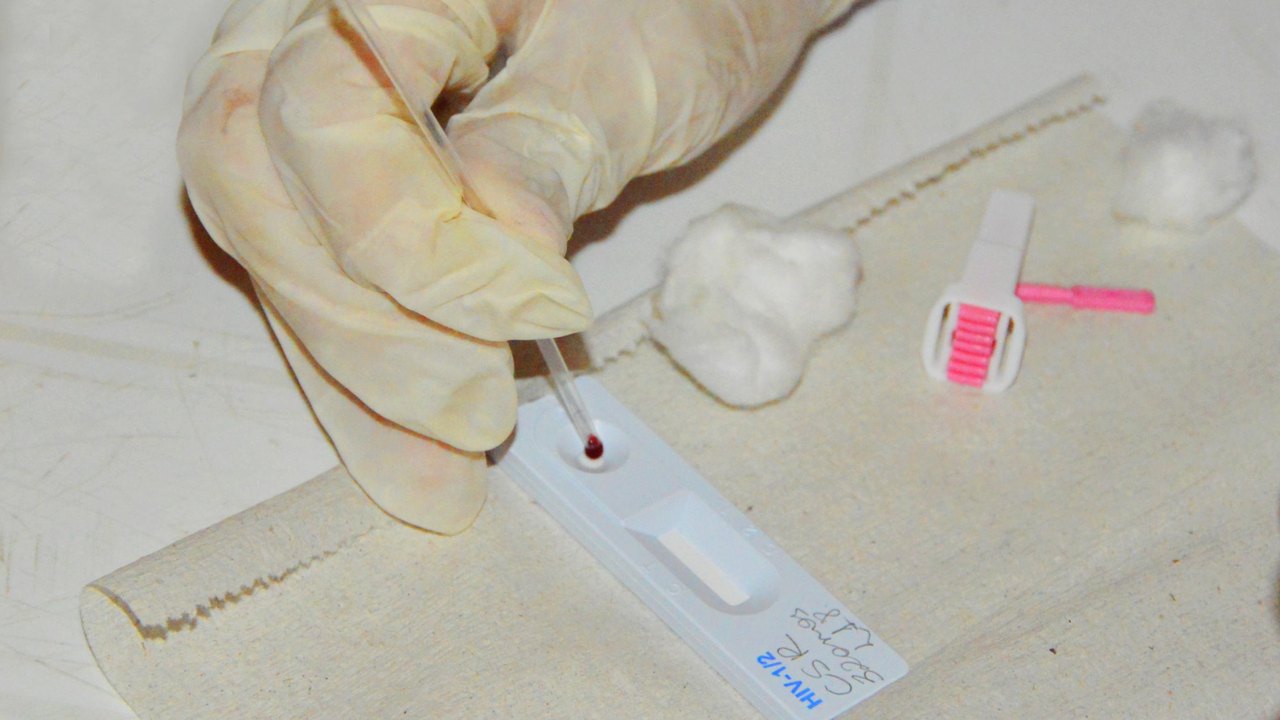 Secretaria de Estado da Saúde reforça orientação sobre as medidas de prevenção ao HIV