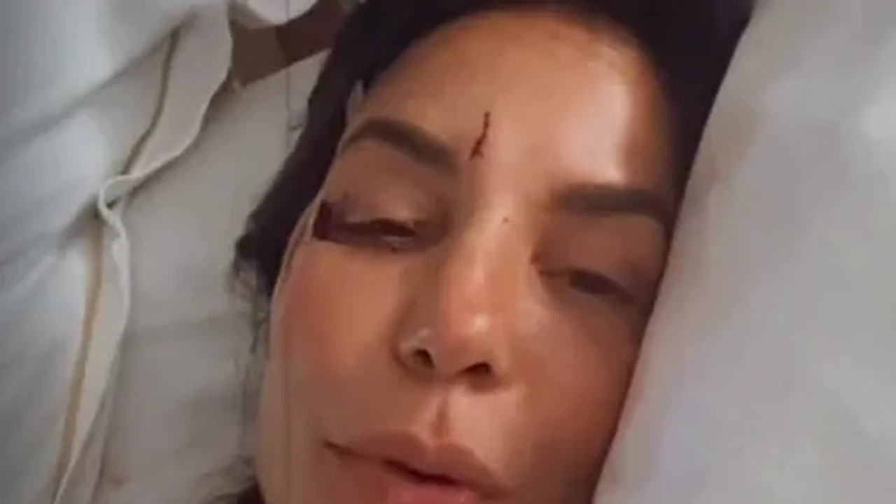 Após queda, Ivete Sangalo passa por cirurgia no rosto e tranquiliza fãs: 'Esse inchaço é natural'