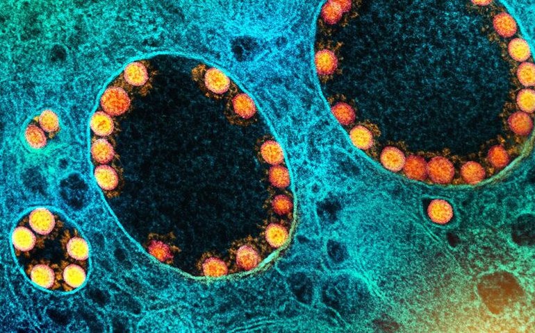 Vacinas agem contra covid grave, mesmo com nova variante
