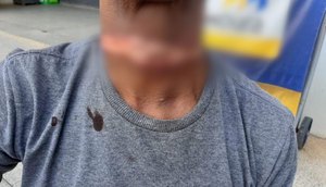 Motociclista fica ferido após enroscar pescoço com fio de internet solto em Lagarto / Foto: Foto: LagartoComoEuVejo/Reprodução