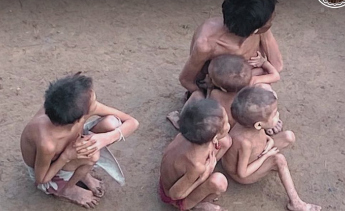 Crianças estavam desnutridas e doentes no território Yanomami