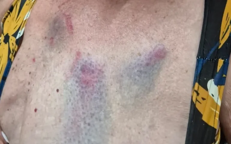 Médica é presa por agredir tia idosa de 77 anos  em Arapiraca