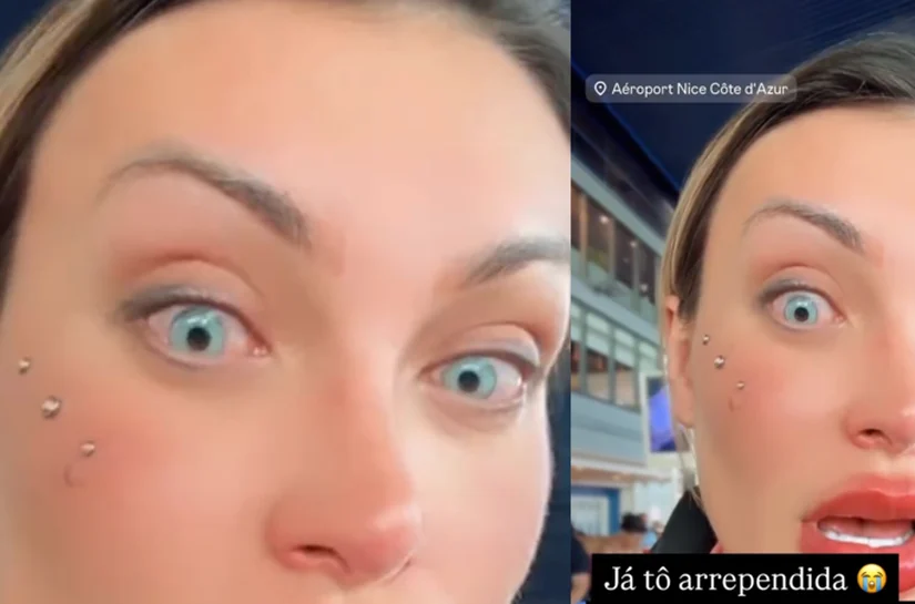 Andressa Urach: Arrependimento após cirurgia para mudar a cor dos olhos na França