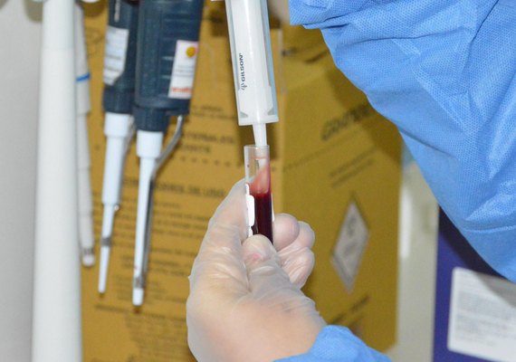 Secretaria de Saúde promove evento para discutir ações voltadas ao controle da doença meningocócica em Alagoas