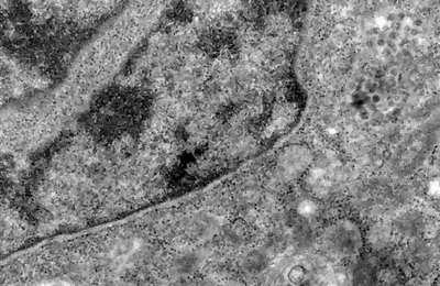 Covid-19: o que se sabe até agora da variante Ômicron