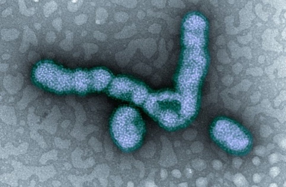 h1n1