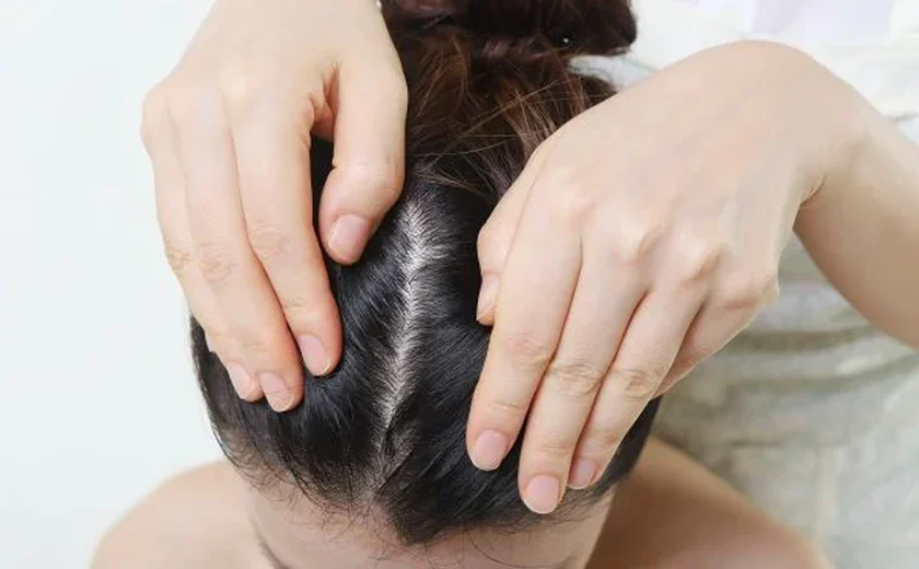 Câncer no couro cabeludo: saiba como prevenir e quando se preocupar