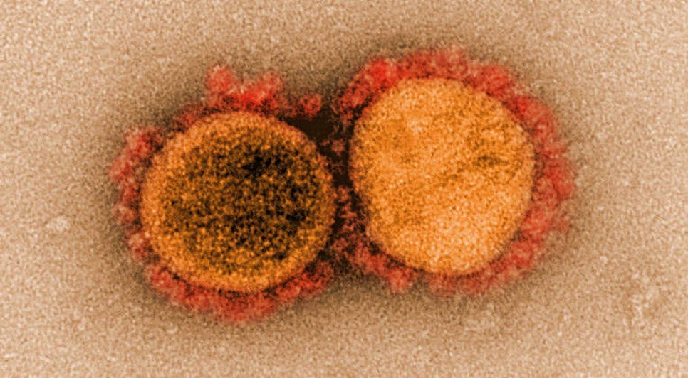 Ministério da Saúde confirma primeiro caso da subvariante Ômicron XE no Brasil; entenda / Foto: Foto: National Reprodução/Institute Of Allergy and Infectious Diseases