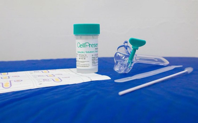 Saiba como é o novo teste do SUS para detectar câncer do colo do útero