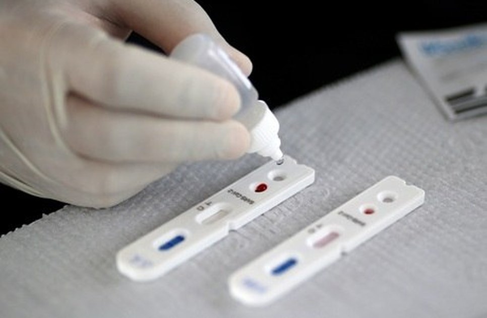 teste coronavirus