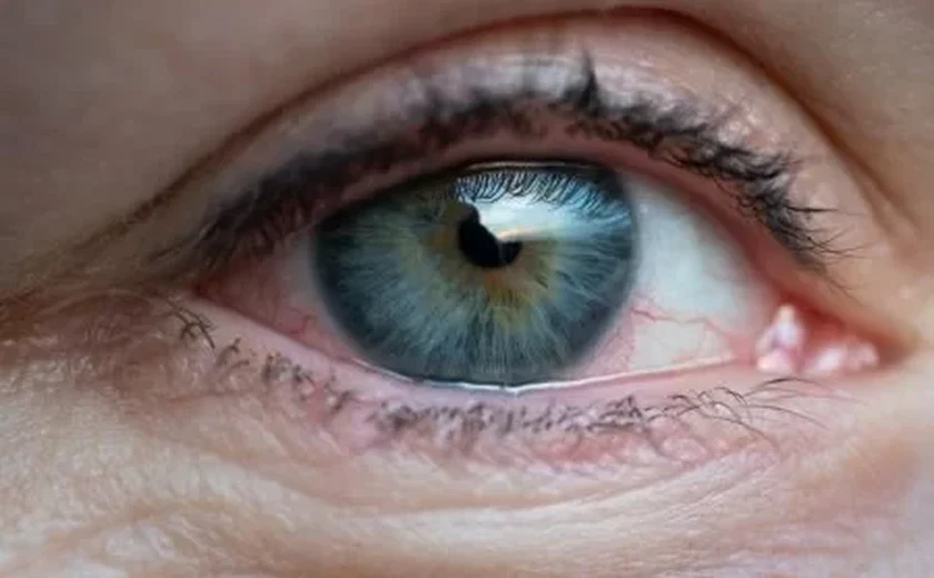 Visão embaçada pode ser diabetes descontrolada. Saiba outros sinais