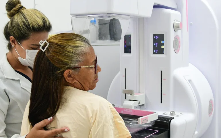 Exames gratuitos de mamografia sem pedido médico são oferecidos em SP; veja como agendar