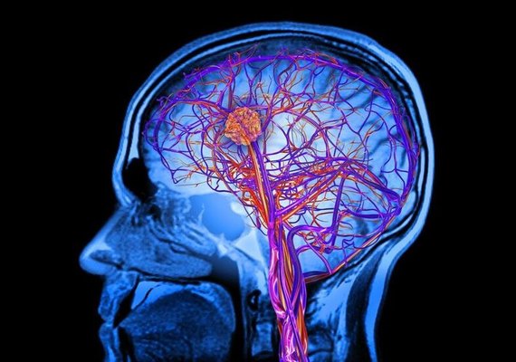 Alzheimer assintomático: cientistas investigam 12 pacientes ‘resilientes’ que não dão sinais da doença; entenda