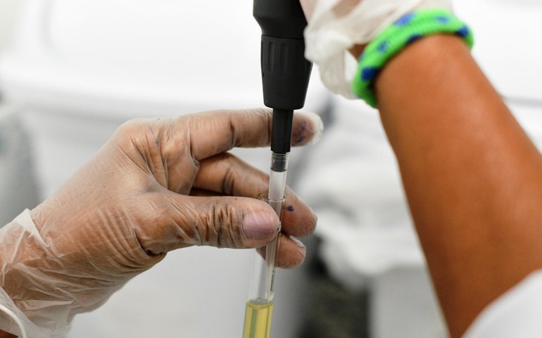 Hemocentro de Alagoas é referência na realização de exames para o diagnóstico de leucemia