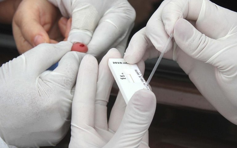 Município acompanha pesquisadores do ibope em trabalho sobre a propagação do coronavírus