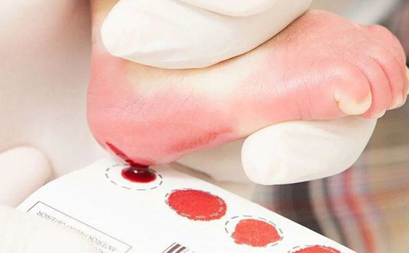 Dia Nacional do Teste do Pezinho conscientiza sobre importância do exame