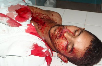 Homem morre a caminho do hospital São Vicente depois de ser ferido a bala