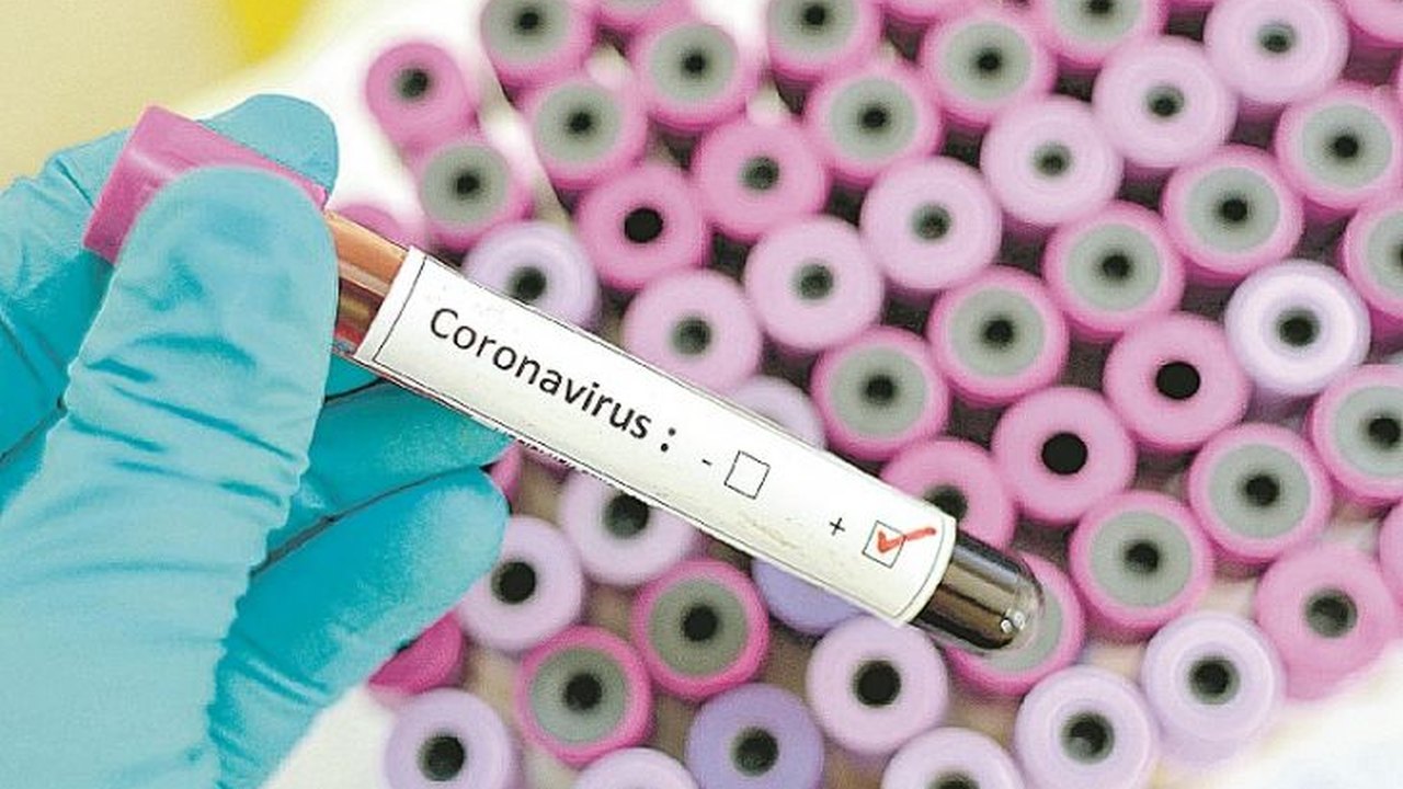 Argentina chega a 262 mortes pelo novo coronavírus